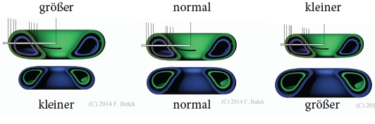 doppeltorus-doppelt-steht-03-b-004.jpg