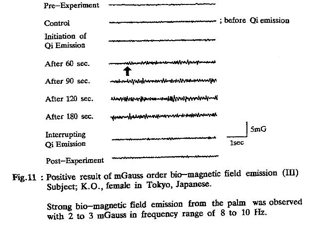 seto--detection-of-extraordinary-large-bio-magnetic-1992-ocr-abb11_g.jpg